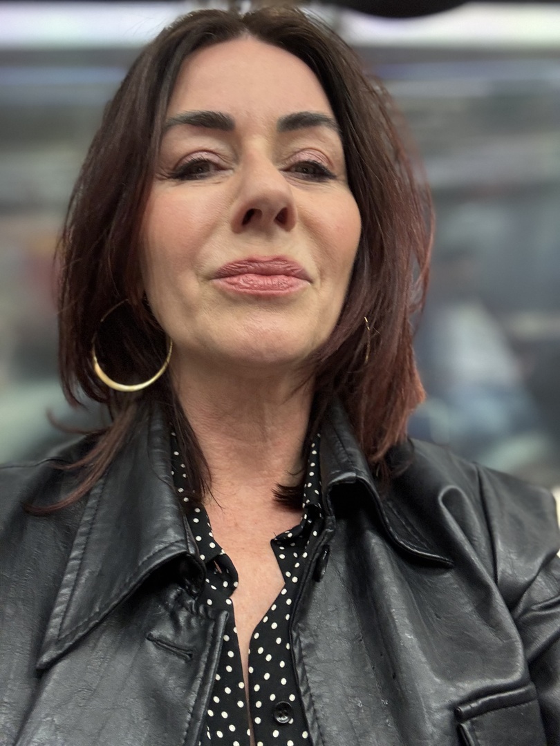 Polly Vernon before eye lift surgery.